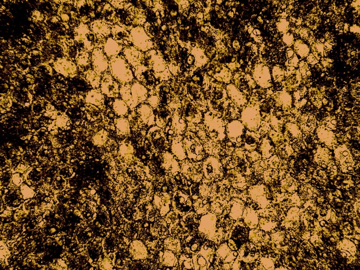 LS Seed Unstained