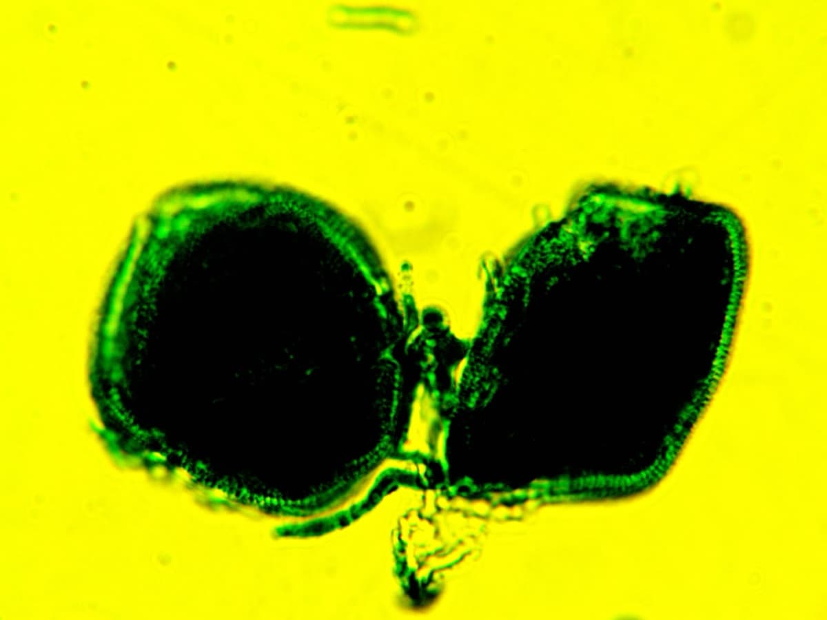 Laboratory specimen 1