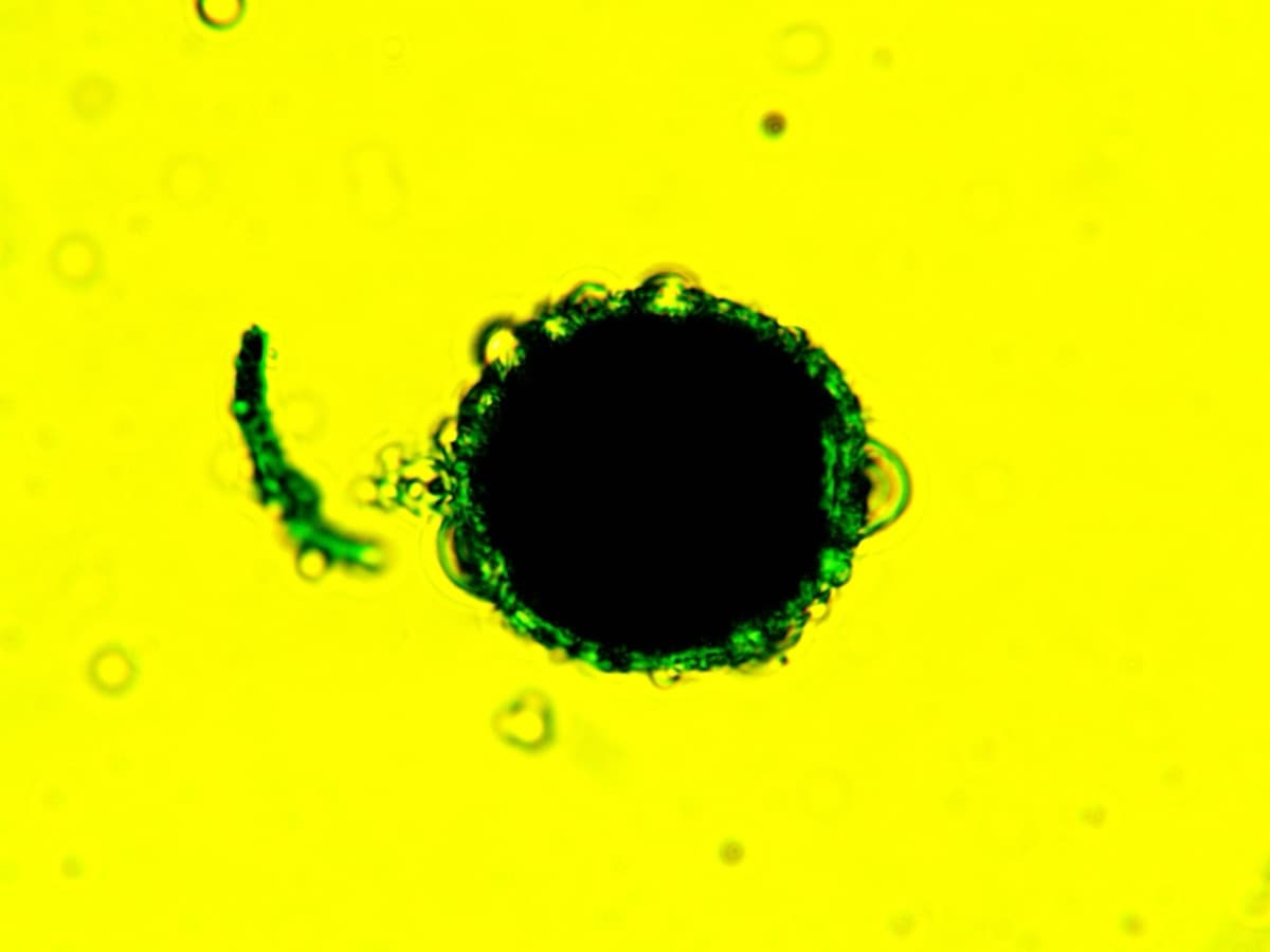 Laboratory specimen 10