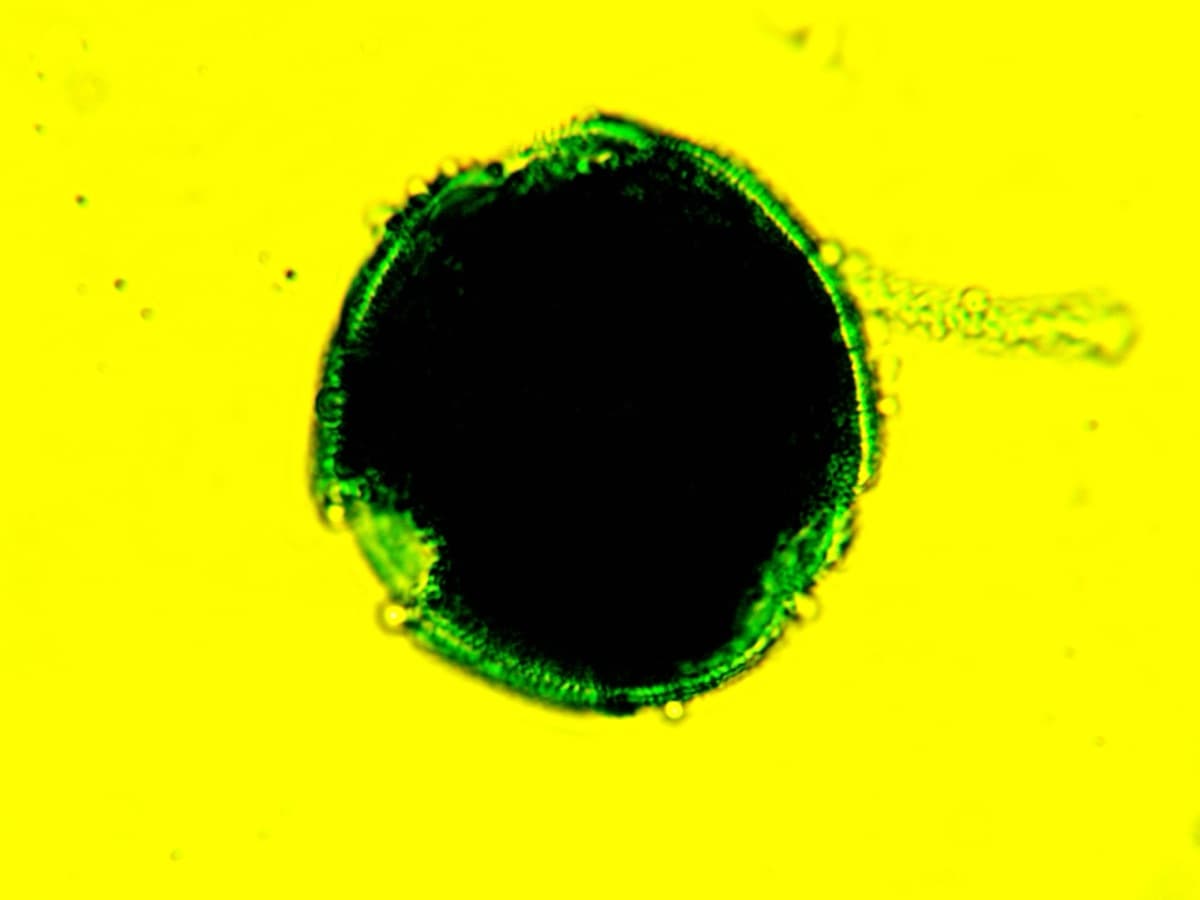 Laboratory specimen 11