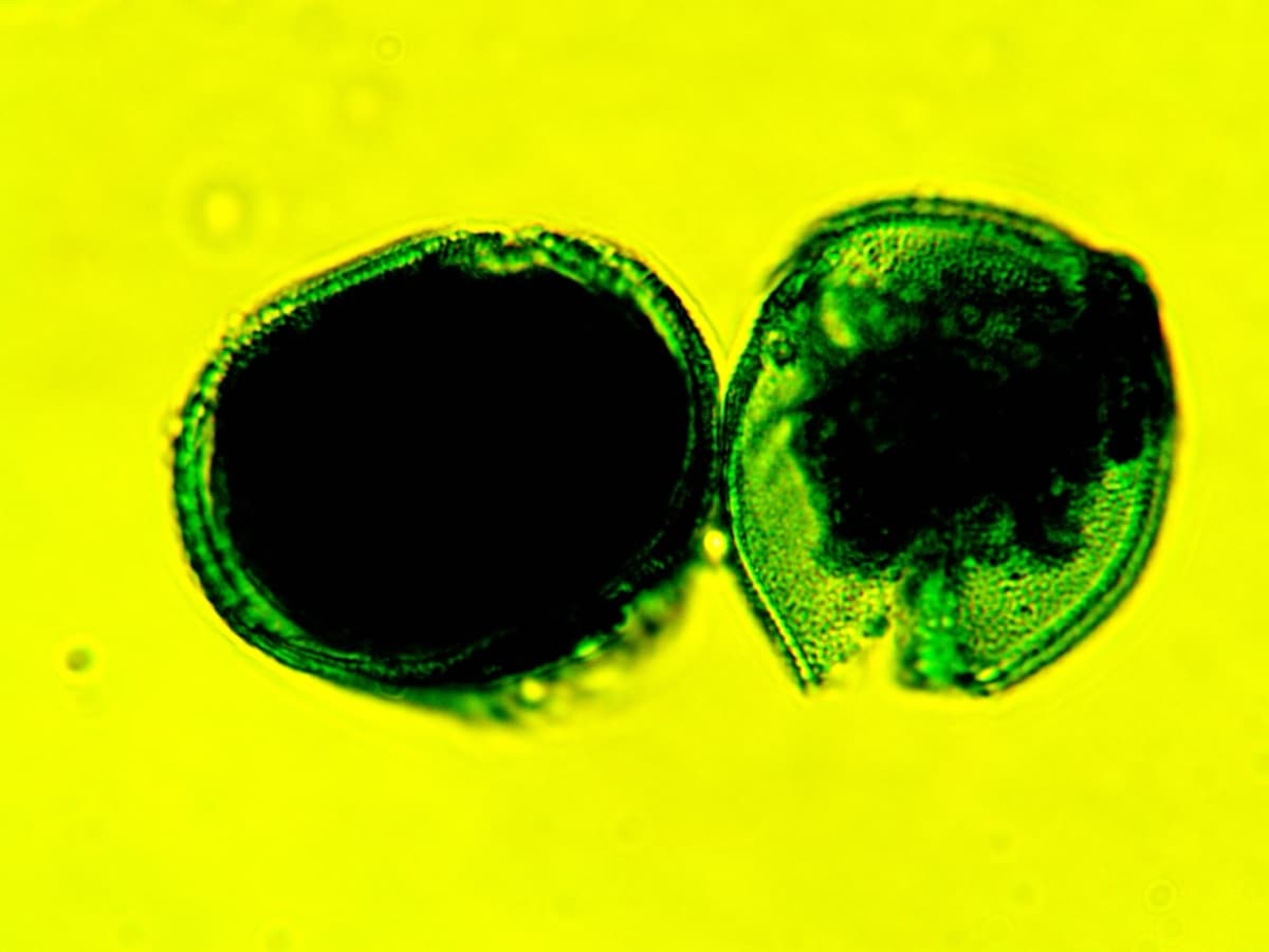 Laboratory specimen 14