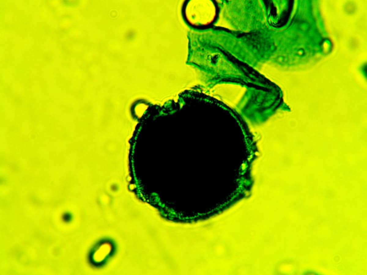 Laboratory specimen 16