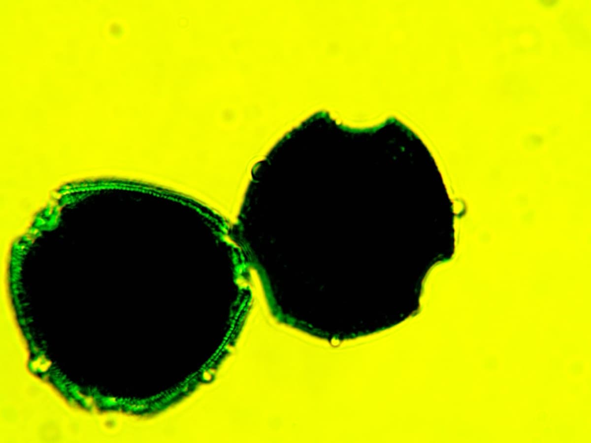 Laboratory specimen 18