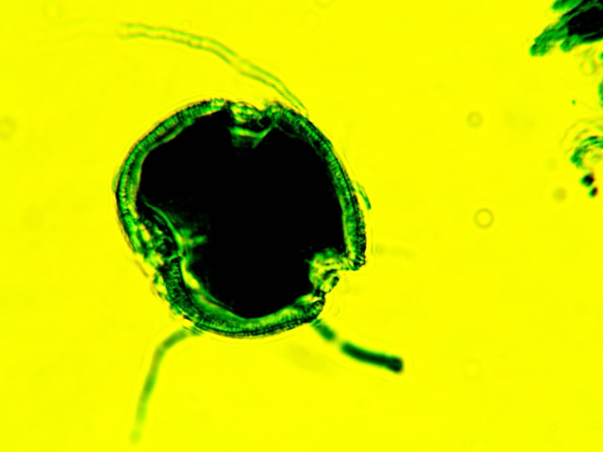 Laboratory specimen 19