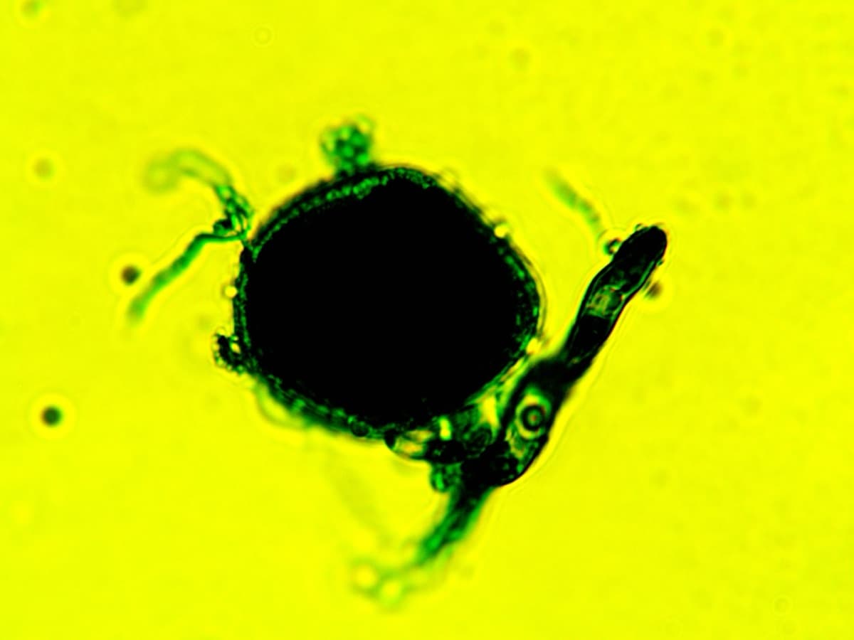 Laboratory specimen 20