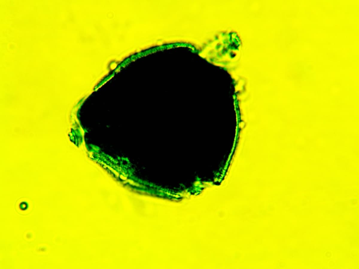 Laboratory specimen 21
