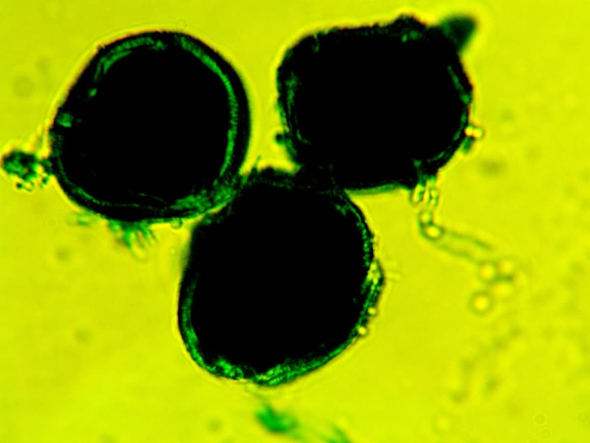 Laboratory specimen 22