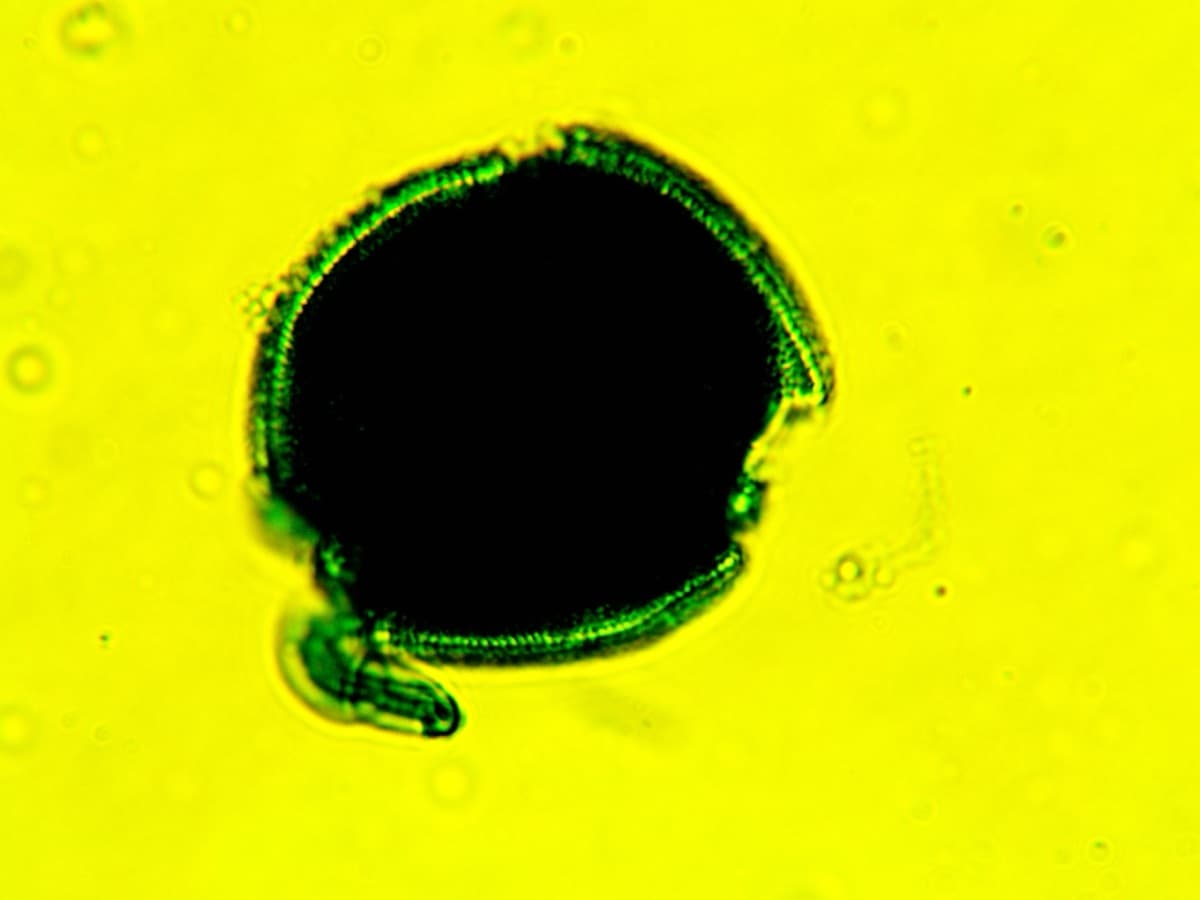 Laboratory specimen 24