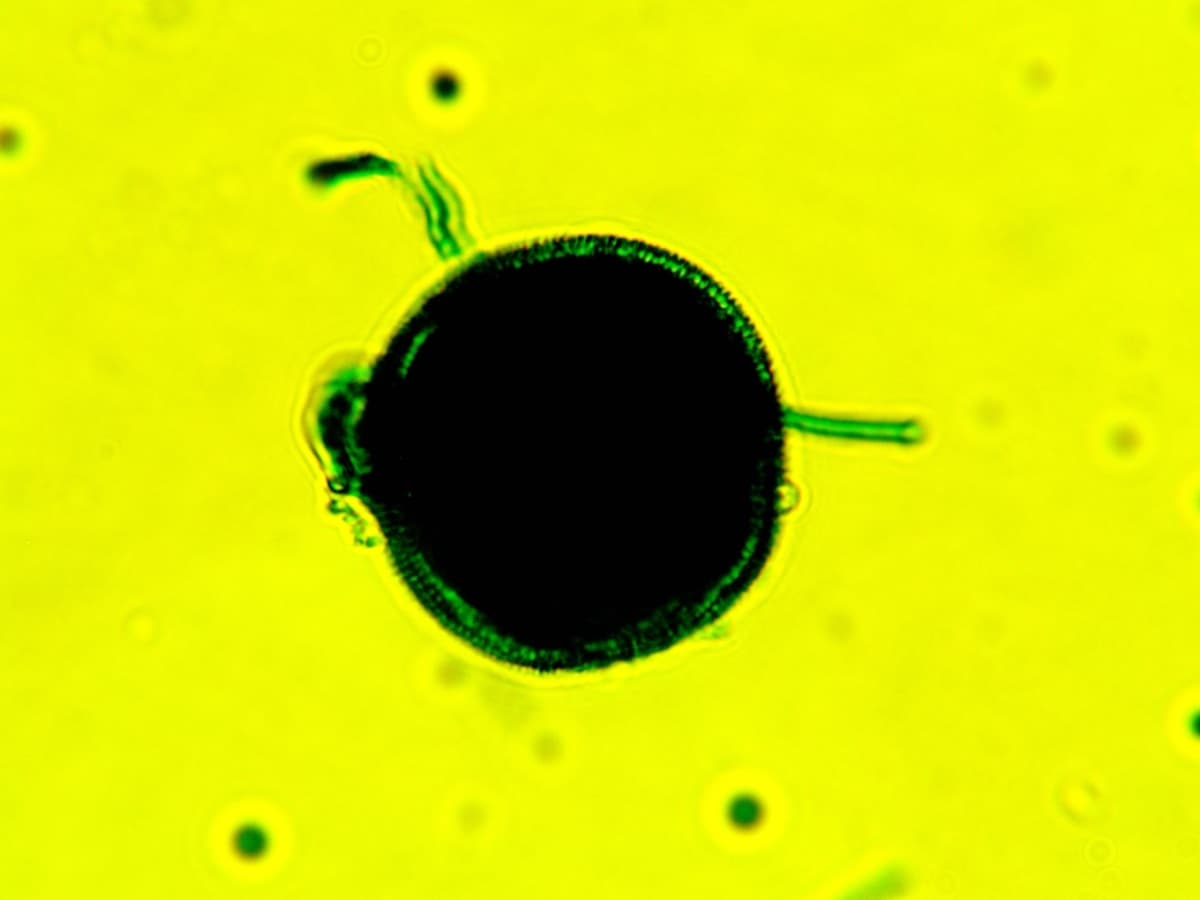 Laboratory specimen 28