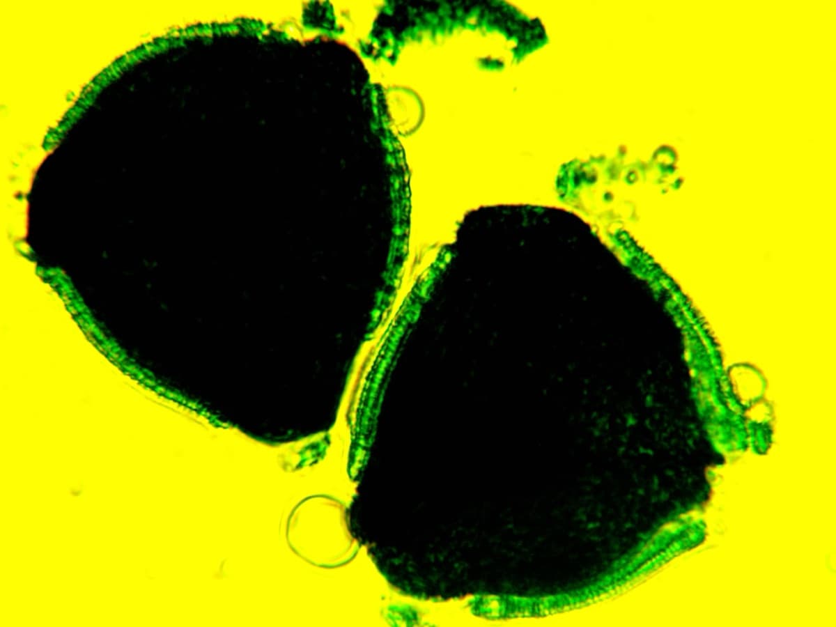 Laboratory specimen 3