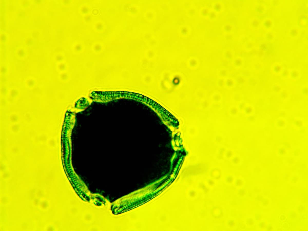 Laboratory specimen 30
